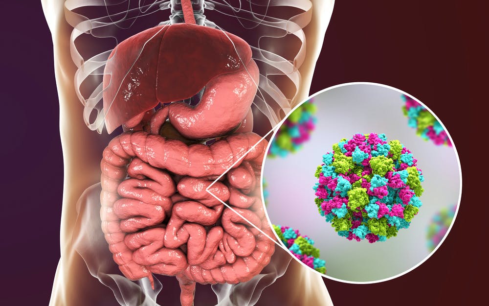 Noronavirus