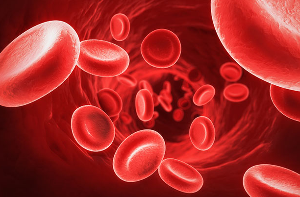 anemia yang disebabkan oleh kekurangan zat besi