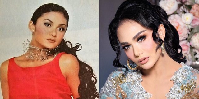 Artis Operasi Plastik