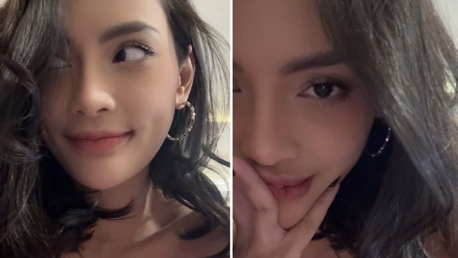 Erika Carlina USG Kehamilan, Netizen Beri Dukungan Penuh