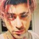 kondisi-terkini-zayn-malik-usai-dirawat-di-rumah-sakit-dan-batalkan-21-jadwal-tur